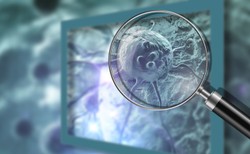 12 prostych kroków, które zmniejszają o połowę ryzyko raka