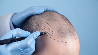 czy usługi trychologa są z vat?