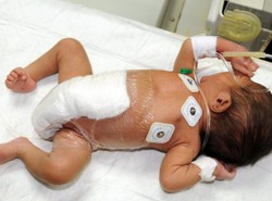 Urodził się z sześcioma nogami. Ma już tylko dwie