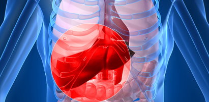 Plamy, dziwne paznokcie, pajączki? To przez chorą wątrobę!