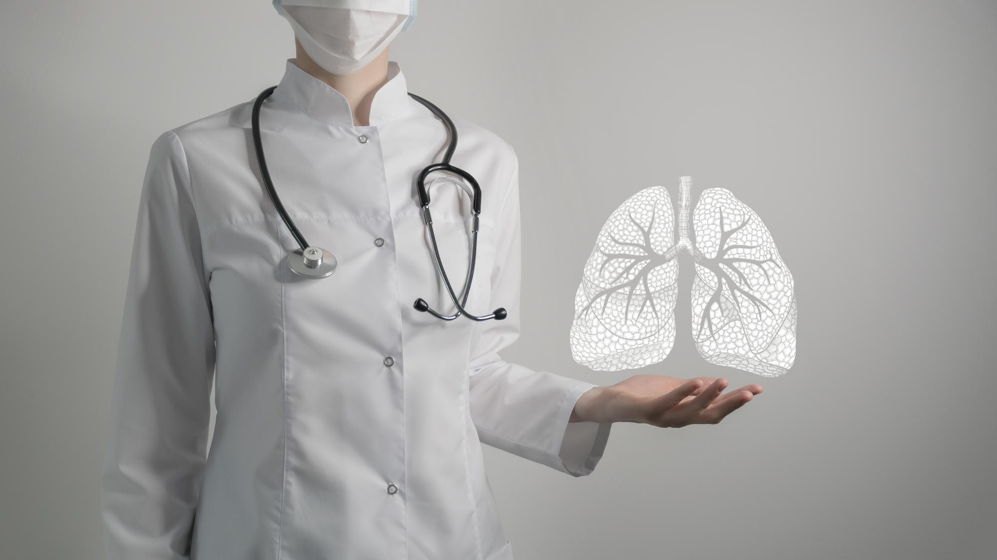 Lekári po vykonaní testov diagnostikovali rakovinu pľúc  (ilustračné foto).