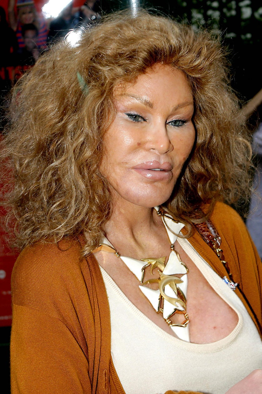 Jocelyn Wildenstein