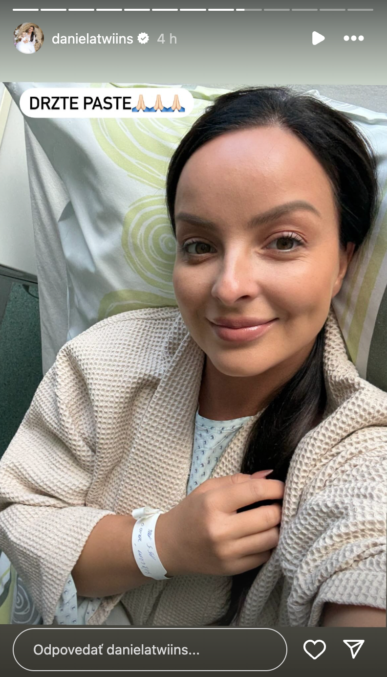 Twiinska Daniela Nízlová pred operáciou.