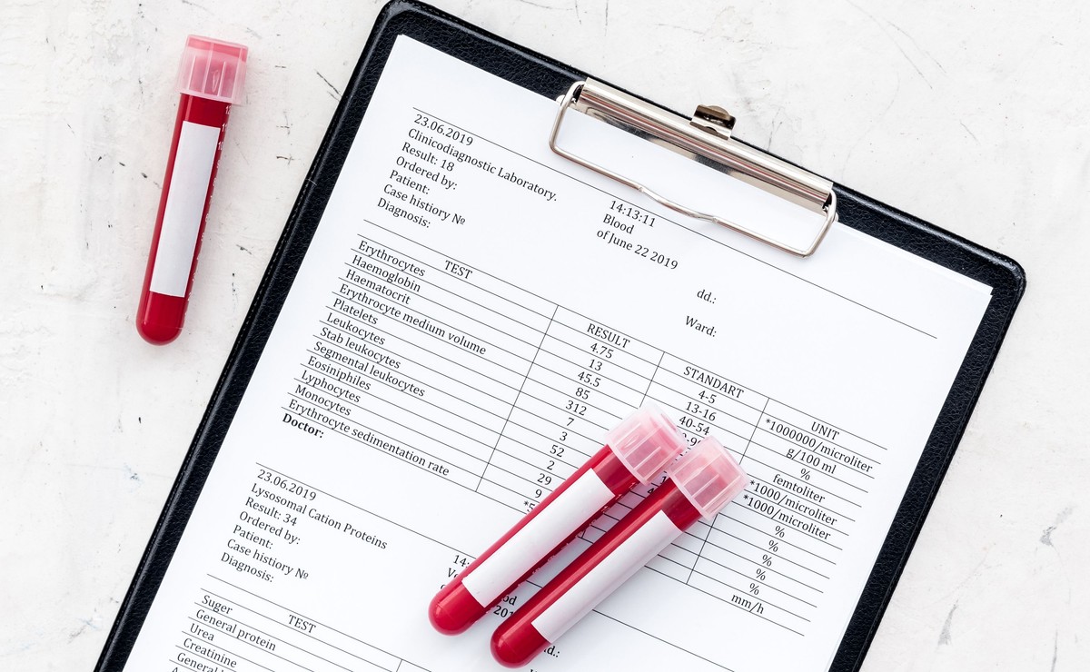 Nocna napadowa hemoglobinuria – rzadka choroba, którą da się leczyć