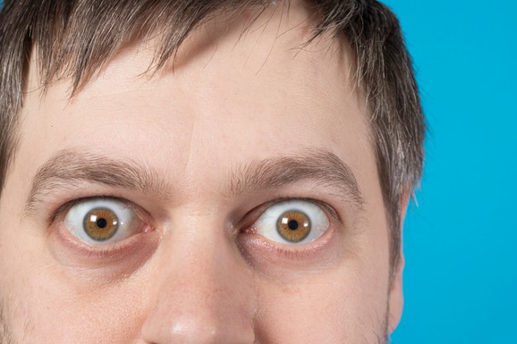 Povučeno više od 3 miliona bočica kapi za oči! Postoji rizik od bakterija i gljivica: Šta to znači za potrošače?