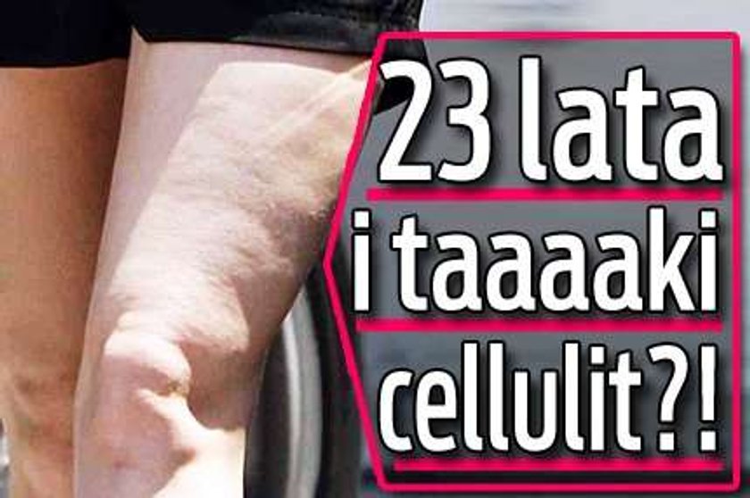 23 lata i taaaaki cellulit?!