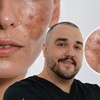 Dr Branislav Lukić, specijalista oftalmologije i lekar estetske medicine