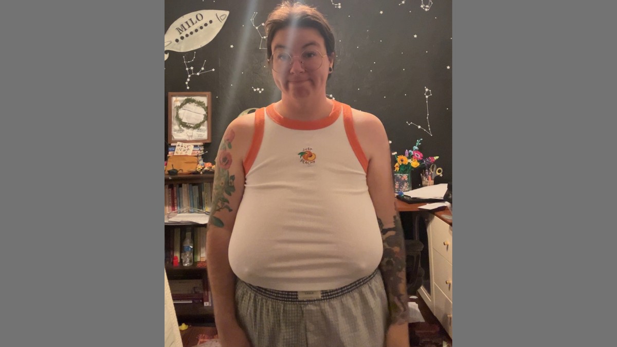 Kameron Lajt pre operacije