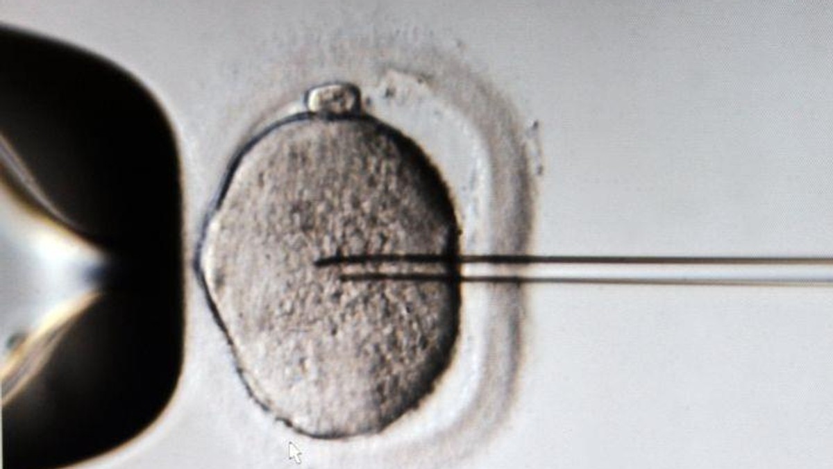 In vitro komórka jajowa