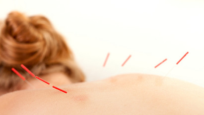Akupunktúrás kezelés során lyukasztották át egy nő tüdejét