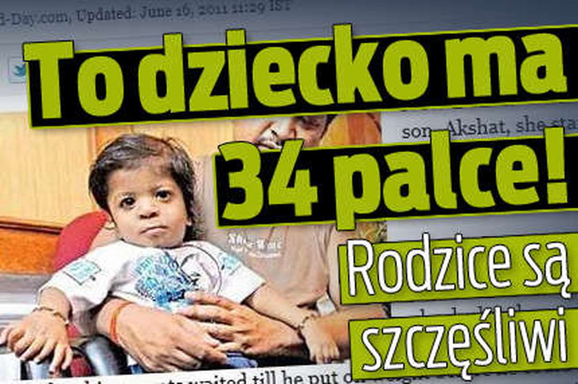 To dziecko ma 34 palce! Rodzice są szczęśliwi