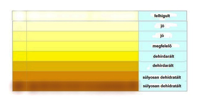 cukorbetegség vizelet színe