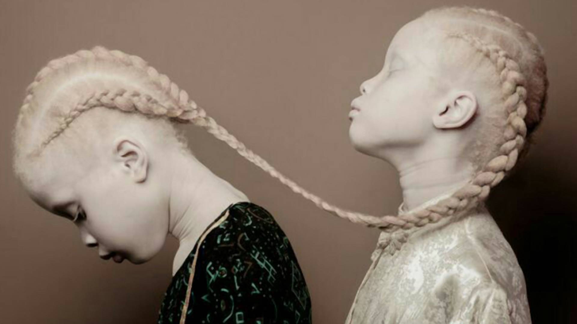 Jedinečné a krásne: Dvojičky s albinizmom búrajú normy módneho priemyslu