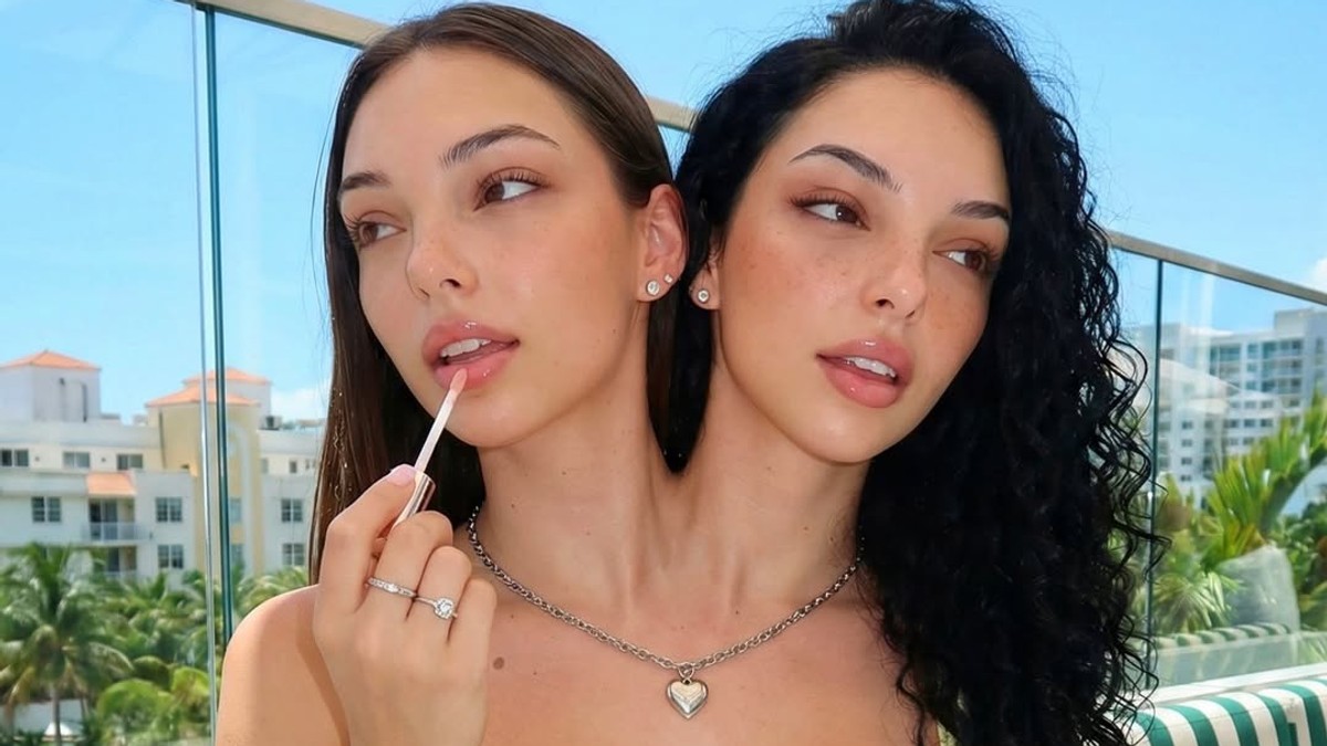 Sijamske bliznakinje Valerija i Kamila