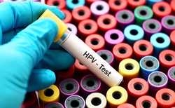 Kiedy będą widoczne efekty programu szczepień przeciw HPV? Wirusolog wyjaśnia