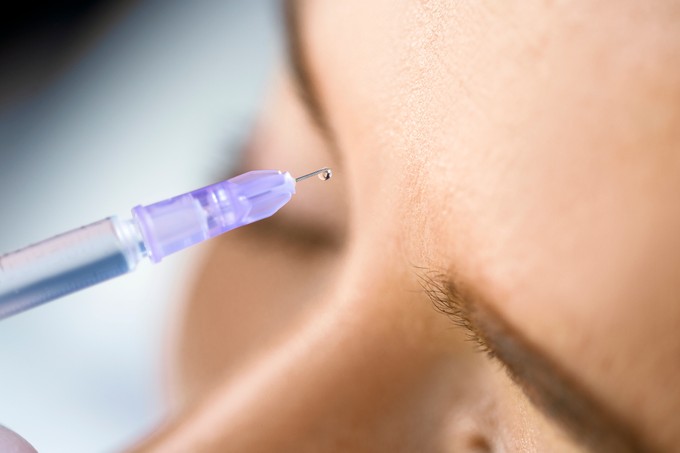 Botox: nemcsak a ráncok, hanem szorongás és depresszió ellen is hatásos lehet