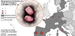 Małpia ospa u ludzi w kilku krajach  Europy – ECDC ocenia sytuację