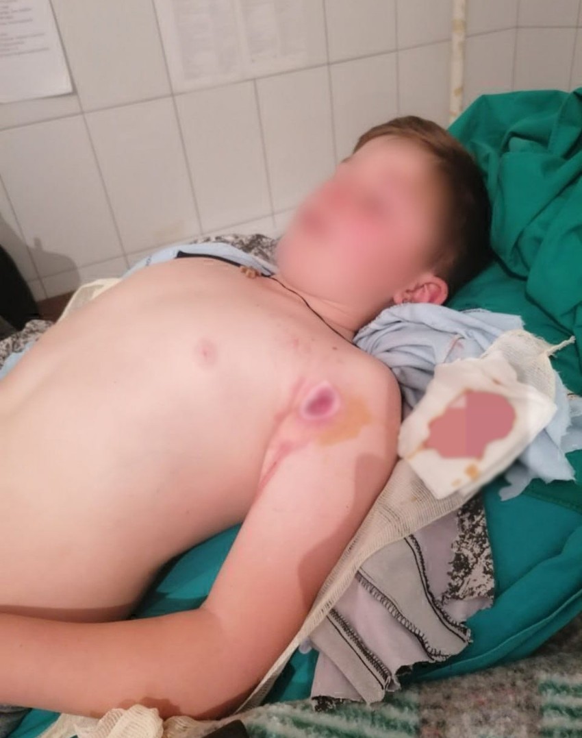 Stefan Stojanović ranjen u Gotovuši