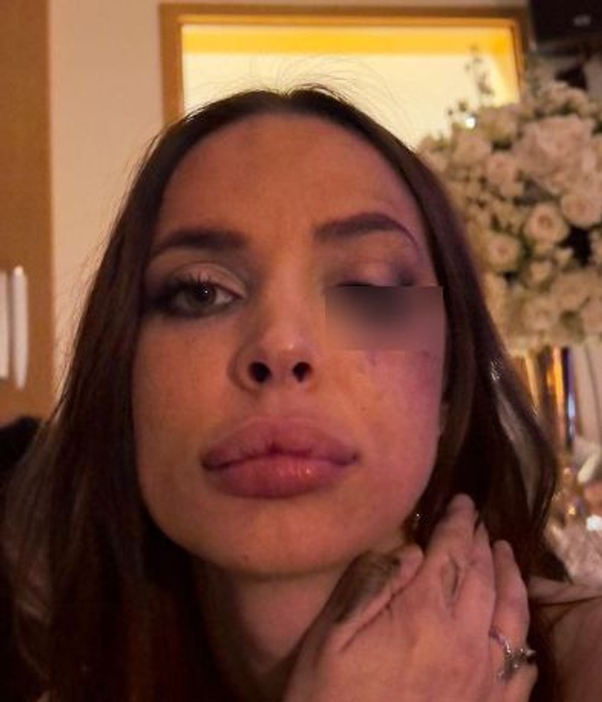 Nataša Šavija pretučena