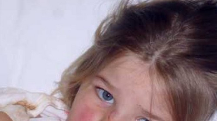 Négy éves kislány arcát roncsolta szét  a kővel