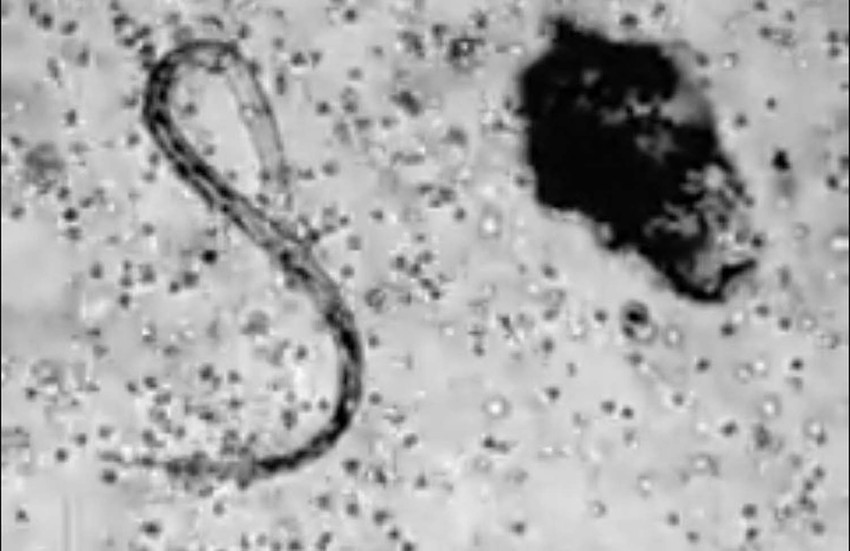 Bela krvna zrnca napadaju valjkastog crva