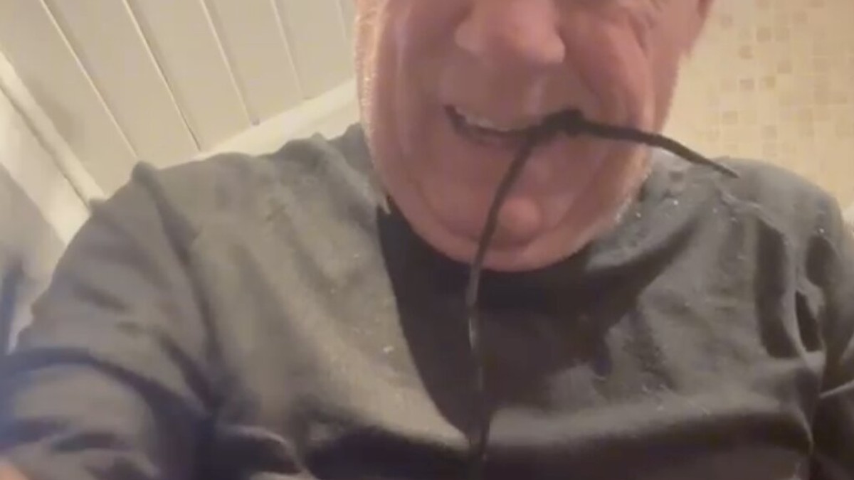 Zbog predugih redova kod stomatologa rešio da sam sebi IZVADI ZUB, pa sve objavio na internetu: Kada budete videli kako ga je ISČUPAO neće vam biti dobro