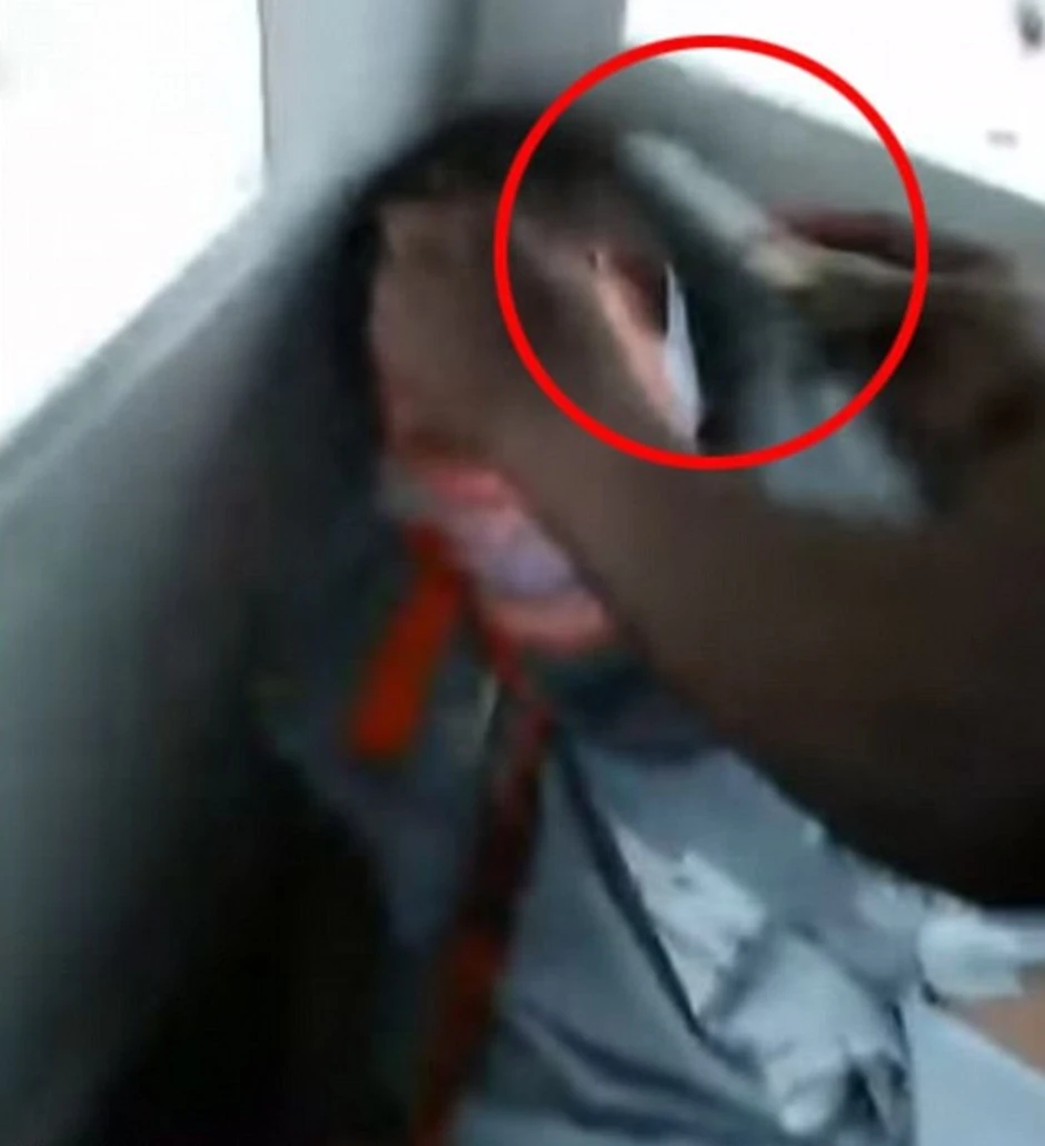 Sekli su mu kosu sve dok nije počeo da krvari