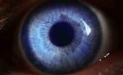 Nowy sposób leczenia cukrzycy - implant wszczepiany do oka. "Wydarzenie zmieniające życie"