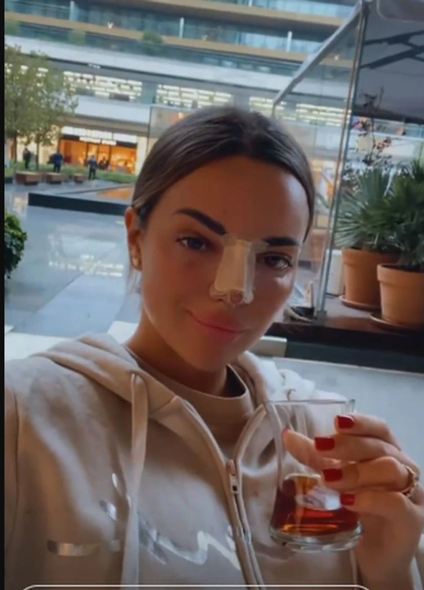 Sofija Šašić operisala nos