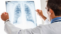 Choroby płuc - współczesne wyzwania