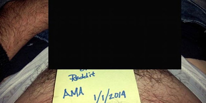 Anonimni muškarac podelio svoju "posebnost" sa internet populacijom