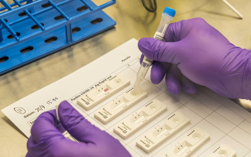 Kon: "Mi smo jedina zemlja na svetu gde se korona brojke posmatrju sa nivoa nekakve "teorije zavere", gde se misli da neko nešto krije smišljeno"