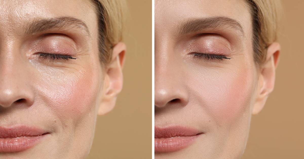 Wsmaruj w skórę i odczekaj chwilę. Ten tani krem działa jak lifting bez igieł