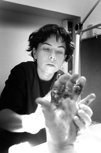 I miejsce w kategorii Portret. Dr Anna Chrapusta zmienia opatrunki po operacji doszywania palców