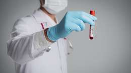 NRL apeluje o wytyczne w sprawie zlecania testów na koronawirusa