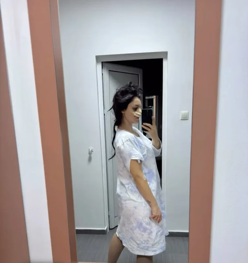 Zvezda Granda operisala nos