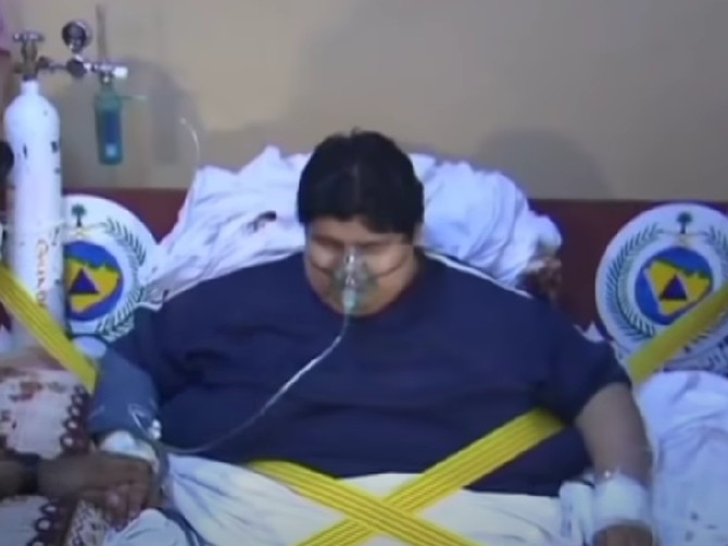 Bio je najdeblji čovek na svetu sa 609 kilograma, a danas ima 68 kg - nećete verovati kako izgleda