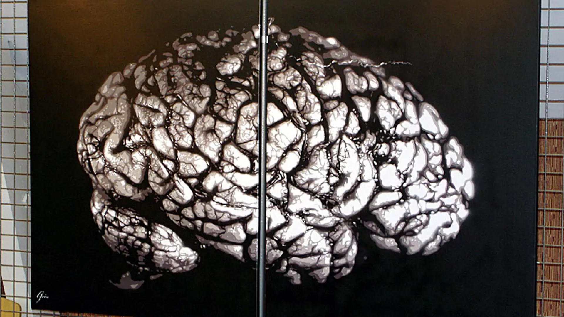 W jaki sposób fałduje się mózg? Naukowcy zaskoczeni wynikami eksperymentu