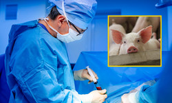 Człowiekowi przeszczepiono nerkę świni. Narząd pracuje poprawnie od miesiąca