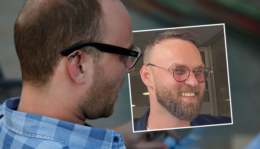 Danijelu Alibabiću gost odgrizao uvo