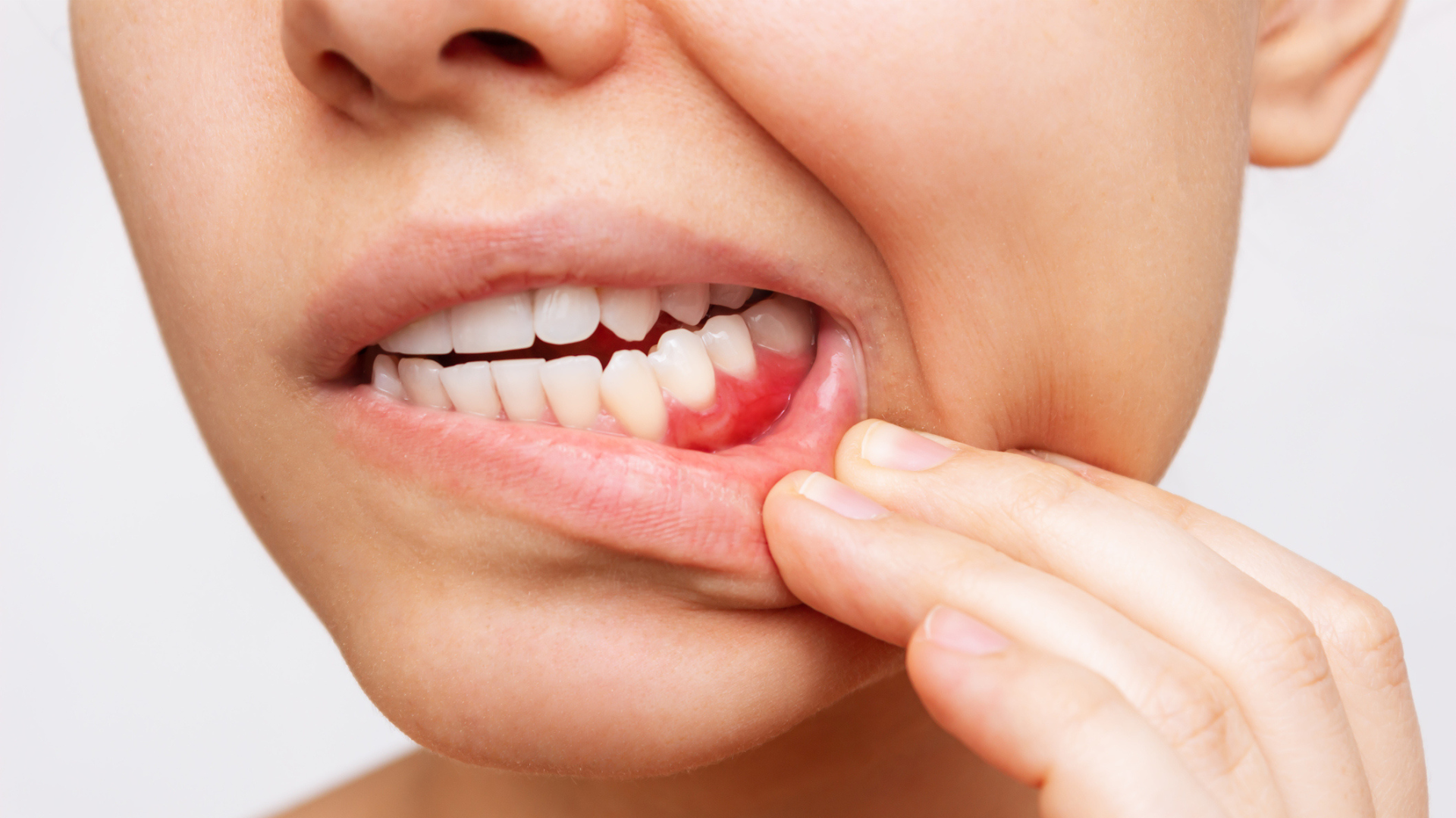 Mnohí mávajú časté nočné mory o vypadávaní zubov.