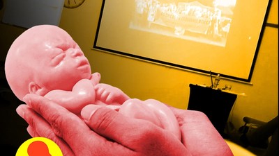 aborcja Fundacja Pro Prawo do życia