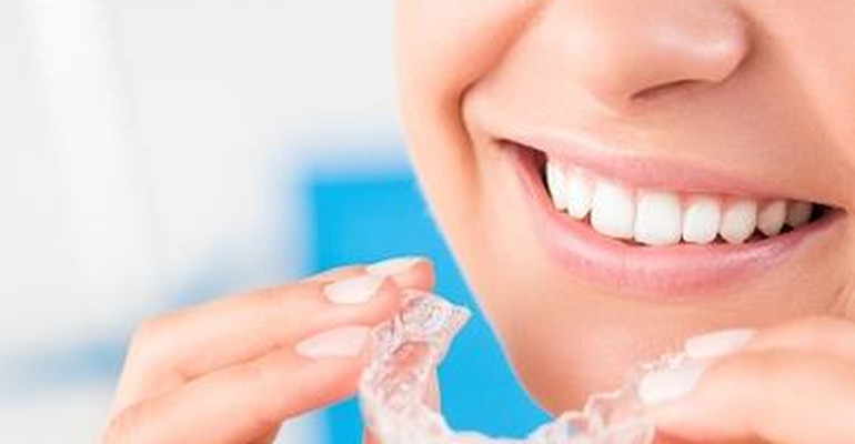 Aparat retencyjny i jego rola w ortodontycznym leczeniu uzębienia