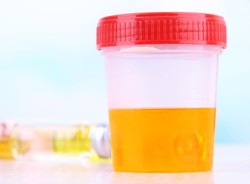 7 zaskakujących faktów na temat... moczu