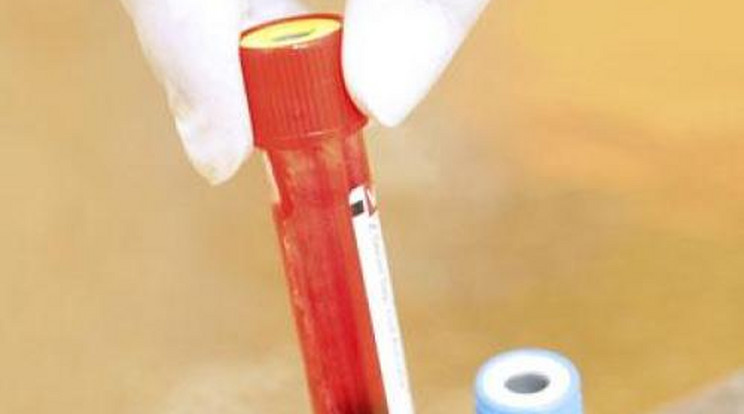 Hatalmas sikert hoztak a HIV-vírus elleni vakcina tesztek
