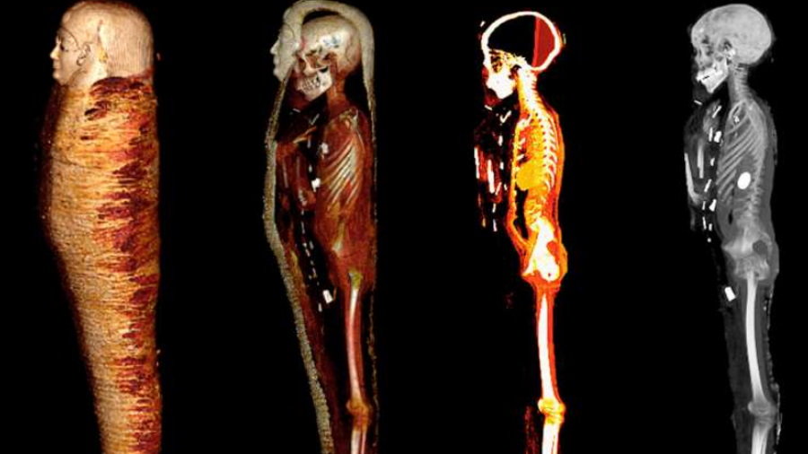 Sekrety mumii „złotego chłopca”. Tomografia ujawniła 49 ukrytych amuletów, fot. SN Saleem, SA Seddik, M el-Halwagy