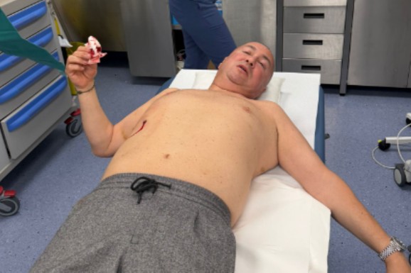 PRVA SLIKA ĐANIJA IZ BOLNICE NAKON ŠTO GA JE GOST UJEO Folker bez majice leži na stolu, ima ranu na stomaku (FOTO)