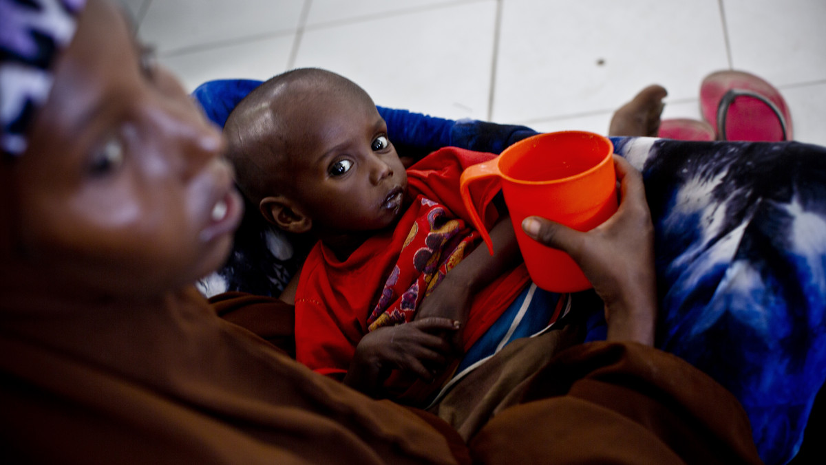 Malutki Abdi ma tylko 20 miesięcy, ale wygląda na o wiele młodszego. Skrajne niedożywienie powoduje, że chłopiec cierpi każdego dnia. Grozi mu śmierć z głodu.