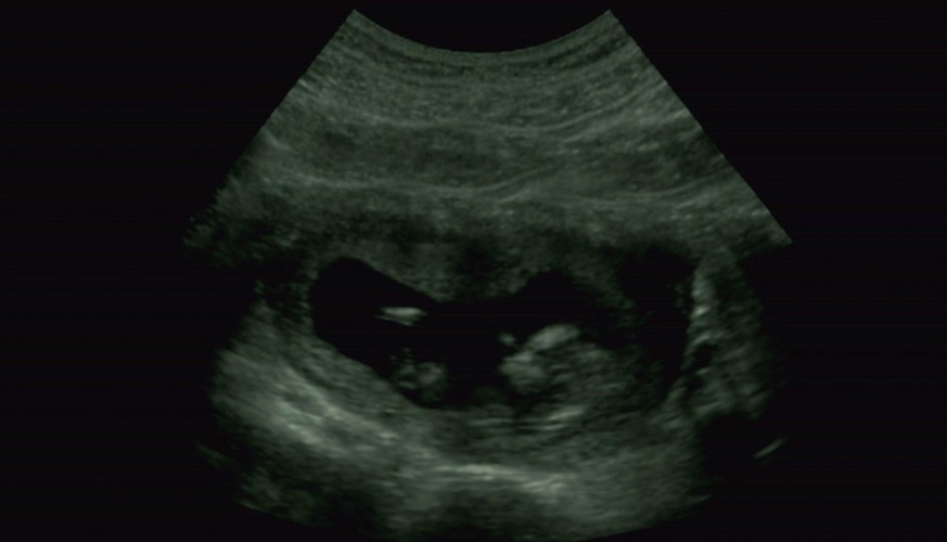 'Beyoncé: Życie to tylko sen'