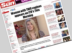 Ta kobieta ma dwie waginy. Jak to możliwe?